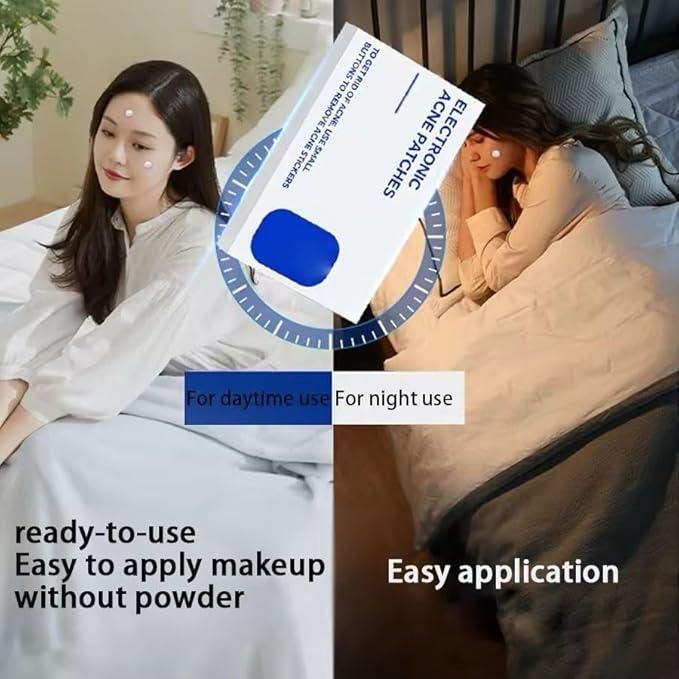 Electric Acne Patches for Face Treatment, White